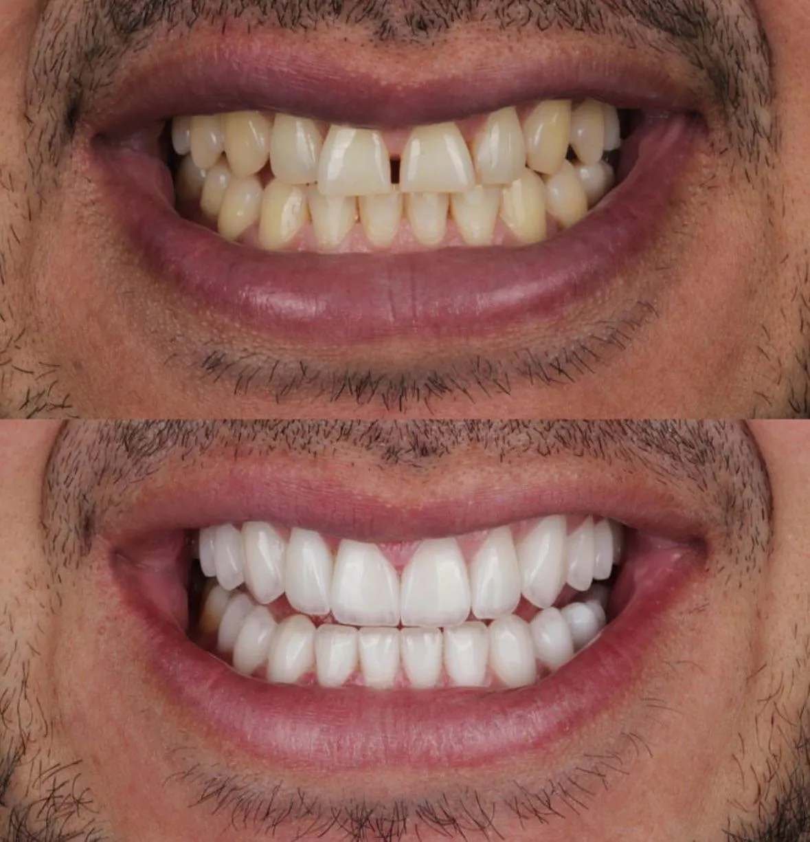 Harmonização Dental