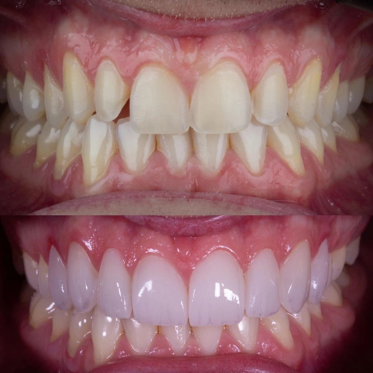 Harmonização Dental