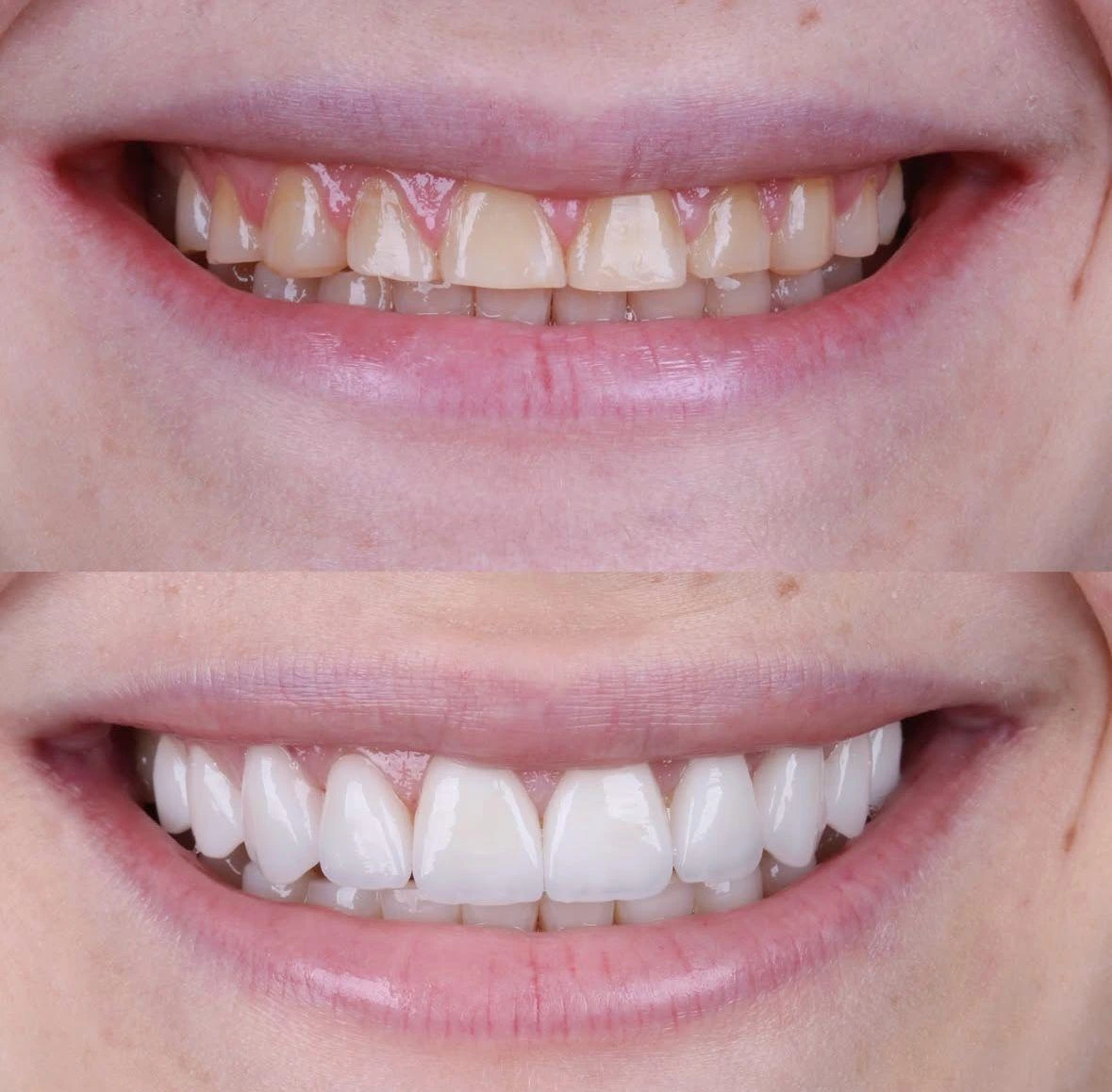 Estética Completa